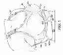 Fig. 08 - Post-surgical garment
