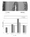 Fig. 02 - METHODS FOR EXTRACTING PLATELETS AND COMPOSITIONS OBTAINED THEREFROM