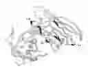 Fig. 01 - VH4 CODON SIGNATURE FOR MULTIPLE SCLEROSIS