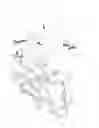 Fig. 15 - VH4 CODON SIGNATURE FOR MULTIPLE SCLEROSIS