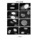Fig. 10 - Methods and Compositions for Inhibiting Tumor Cell Proliferation