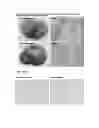 Fig. 02 - Composition for regenerating normal tissue from fibrotic tissue