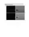 Fig. 04 - Composition for regenerating normal tissue from fibrotic tissue