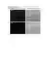 Fig. 08 - Composition for regenerating normal tissue from fibrotic tissue