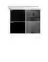Fig. 09 - Composition for regenerating normal tissue from fibrotic tissue