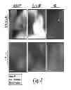 Fig. 05 - Cancer Cell Targeting Using Nanoparticles