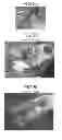 Fig. 08 - Compositions and methods for treating hoof diseases