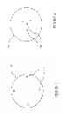 Fig. 04 - Hydromethanation of a carbonaceous feedstock