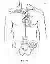 Fig. 06 - Methods, devices and systems for counterpulsation of blood flow to and from the circulatory system