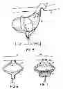 Fig. 09 - Methods, devices and systems for counterpulsation of blood flow to and from the circulatory system