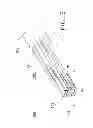Fig. 08 - SPACE-OPTIMIZED VISUALIZATION CATHETER