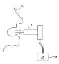 Fig. 01 - APPARATUS, SYSTEM AND METHOD FOR DETECTION AND DELIVERY OF A MEDICINAL DOSE