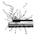 Fig. 01 - Integrated needle and test strip with aspiration apparatus and method of use
