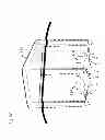 Fig. 08 - Neural interface device and insertion tools