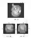 Fig. 08 - In-vivo visualization systems