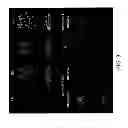 Fig. 09 - Intelligent Atlas for Automatic Image Analysis of Magnetic Resonance Imaging
