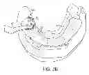 Fig. 06 - IMAGE-OVERLAY MEDICAL EVALUATION DEVICES AND TECHNIQUES