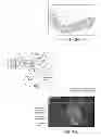Fig. 09 - IMAGE-OVERLAY MEDICAL EVALUATION DEVICES AND TECHNIQUES