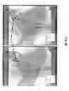 Fig. 07 - Method for performing dynamic registration, overlays, and 3D views with fluoroscopic images