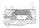 Fig. 01 - Systems and methods for radiographically identifying an access port