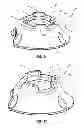 Fig. 08 - Systems and methods for radiographically identifying an access port