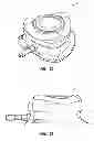 Fig. 30 - Systems and methods for radiographically identifying an access port
