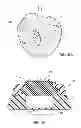 Fig. 34 - Systems and methods for radiographically identifying an access port