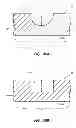 Fig. 35 - Systems and methods for radiographically identifying an access port
