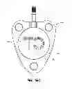 Fig. 41 - Systems and methods for radiographically identifying an access port