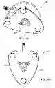 Fig. 43 - Systems and methods for radiographically identifying an access port