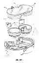 Fig. 49 - Systems and methods for radiographically identifying an access port