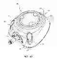 Fig. 53 - Systems and methods for radiographically identifying an access port