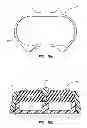 Fig. 58 - Systems and methods for radiographically identifying an access port