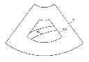 Fig. 01 - ESTIMATING MOTION OF PARTICLE BASED ON VECTOR DOPPLER IN ULTRASOUND SYSTEM