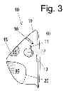 Fig. 04 - Intubation-facilitating oxygen mask