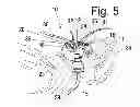 Fig. 06 - Intubation-facilitating oxygen mask