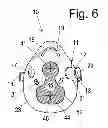 Fig. 07 - Intubation-facilitating oxygen mask