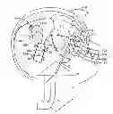 Fig. 01 - Systems and Methods for Assessing the Effectiveness of a Therapy Including a Drug Regimen Using an Implantable Medical Device