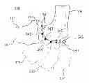 Fig. 01 - Systems and methods for prosthetic component orientation
