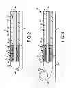 Fig. 03 - Catheter with atraumatic tip