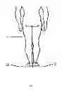Fig. 03 - System, method and apparatus for determining the thickness of orthotics needed to correct for differences in leg length