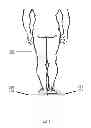 Fig. 06 - System, method and apparatus for determining the thickness of orthotics needed to correct for differences in leg length