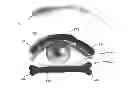Fig. 01 - Dry eye treatment apparatus and methods
