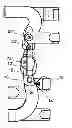 Fig. 01 - Orthotic strapping system