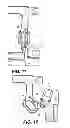 Fig. 06 - Orthotic strapping system