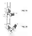 Fig. 08 - Orthotic strapping system