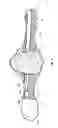 Fig. 07 - ORTHOTIC DEVICE HAVING RELEASABLY ATTACHED PANEL EXTENSIONS AND METHOD FOR USING THE SAME