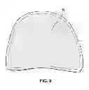 Fig. 09 - ORTHOTIC DEVICE HAVING RELEASABLY ATTACHED PANEL EXTENSIONS AND METHOD FOR USING THE SAME