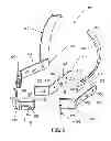 Fig. 03 - Heel stabilization device