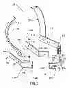 Fig. 04 - Heel stabilization device